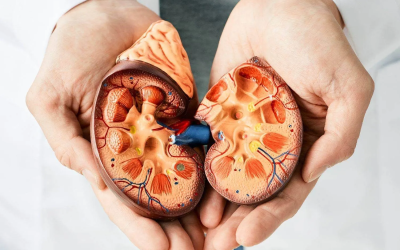 ¿Por qué se forman los cálculos urinarios y cómo prevenirlos?