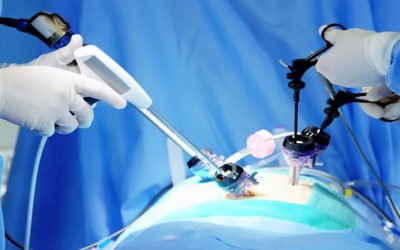 Ventajas de la cirugía laparoscópica para problemas urológicos